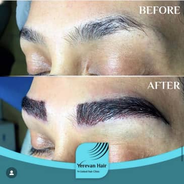 Slider image (5) United Hair Clinic